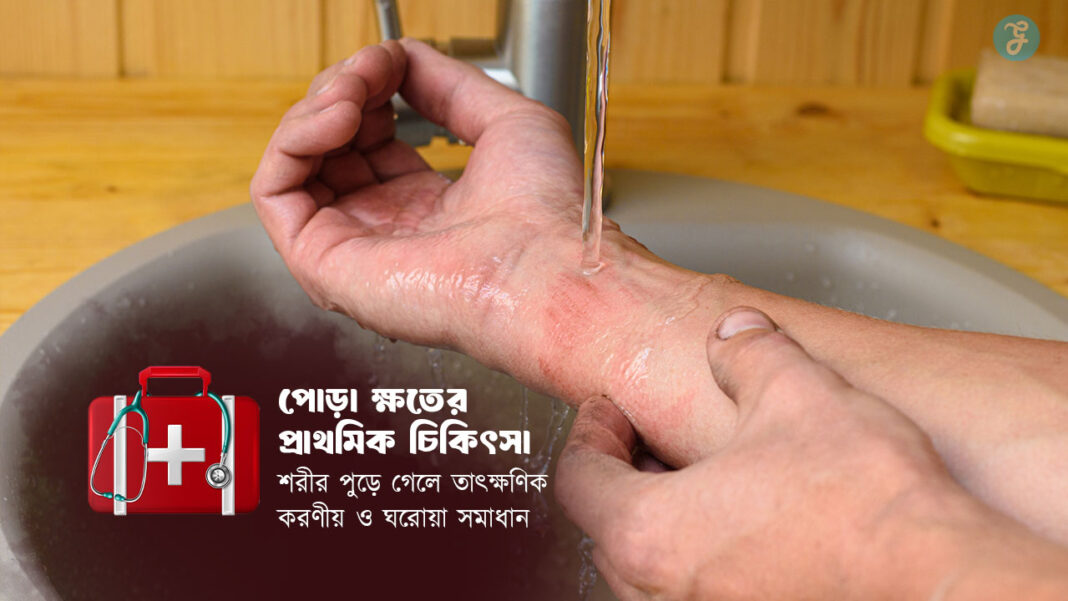 First Aid for Burn Injuries